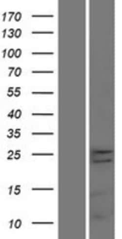 Novus Biologicals&trade;&nbsp;TMEM65 Overexpression Lysate