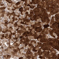 TMEM65 Antibody, Novus Biologicals 0.1mL; Unlabeled:Antibodies, Polyclonal