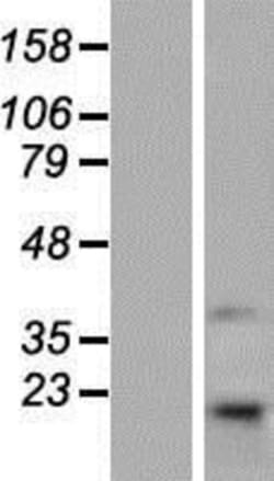 Novus Biologicals&trade;&nbsp;TMEM69 Overexpression Lysate