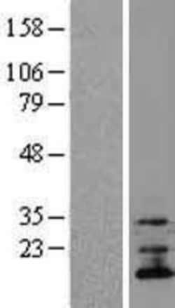 Novus Biologicals&trade;&nbsp;TMEM70 Overexpression Lysate