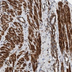 TMEM70 Antibody, Novus Biologicals:Antibodies:Primary Antibodies