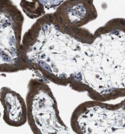 TMEM74 Antibody, Novus Biologicals 25 &mu;L; Unlabeled:Antibodies, Polyclonal