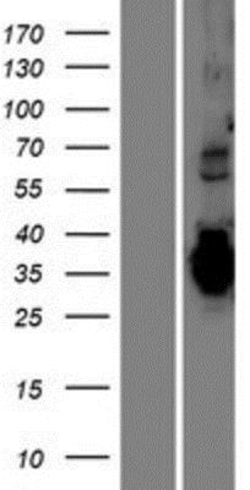 Novus Biologicals&trade;&nbsp;TMEM74B Overexpression Lysate