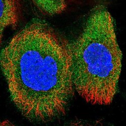 TMEM78 Antibody, Novus Biologicals 0.1mL; Unlabeled:Antibodies, Polyclonal
