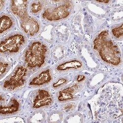 TMEM78 Antibody, Novus Biologicals 0.1mL; Unlabeled:Antibodies, Polyclonal