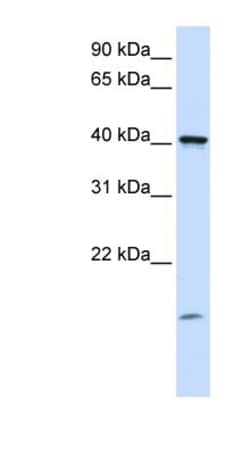 TMEM79 Antibody, Novus Biologicals 20&mu;L; Unlabeled:Antibodies, Polyclonal