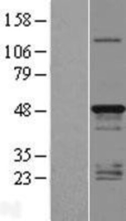 Novus Biologicals&trade;&nbsp;TMEM79 Overexpression Lysate
