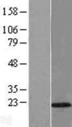 Novus Biologicals&trade;&nbsp;TMEM80 Overexpression Lysate