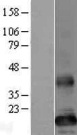 Novus Biologicals™ TMEM86B Overexpression Lysate