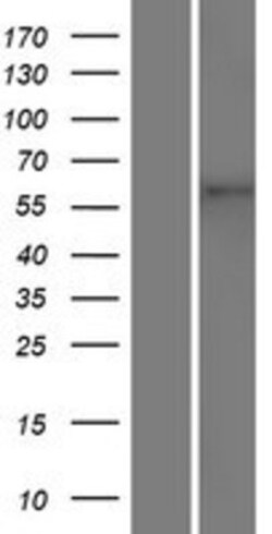 Novus Biologicals™ TMEM87A Overexpression Lysate