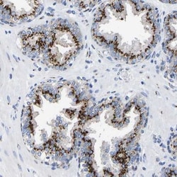 TMEM87A Antibody, Novus Biologicals 0.1mL; Unlabeled:Antibodies, Polyclonal