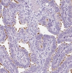TMEM89 Antibody, Novus Biologicals 25 &mu;L | Buy Online | Novus Biologicals | Fisher Scientific