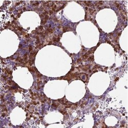 TMEM8 Antibody, Novus Biologicals 25 &mu;L, Unlabeled:Antibodies, Polyclonal