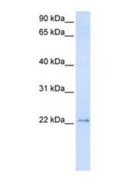 TMEM9 Antibody, Novus Biologicals 0.05mg; Unlabeled:Antibodies, Polyclonal
