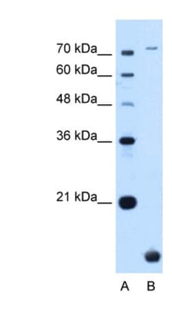 TMEM91 Antibody, Novus Biologicals 100&mu;L; Unlabeled:Antibodies, Polyclonal