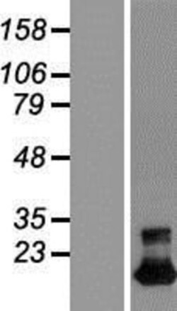 Novus Biologicals™ TMEM92 Overexpression Lysate