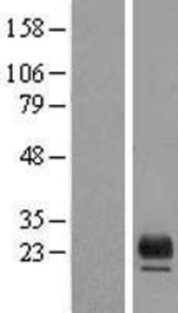 Novus Biologicals&trade;&nbsp;TMEM98 Overexpression Lysate