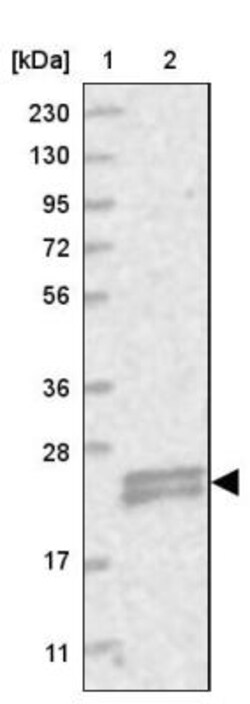 TMEM9B Antibody, Novus Biologicals:Antibodies:Primary Antibodies