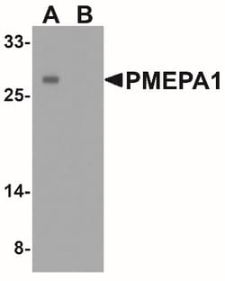 TMEPAI Antibody - BSA Free, Novus Biologicals 0.025 mg, Unlabeled:Antibodies,