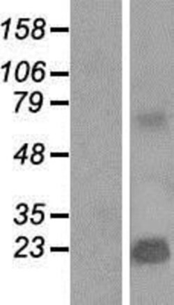 Novus Biologicals&trade;&nbsp;TMEPAI Overexpression Lysate