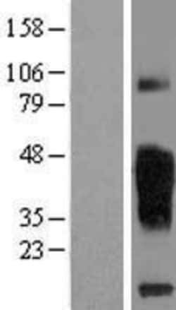 Novus Biologicals&trade;&nbsp;TMIGD2 Overexpression Lysate