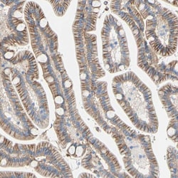 TMIGD2 Antibody, Novus Biologicals:Antibodies:Primary Antibodies