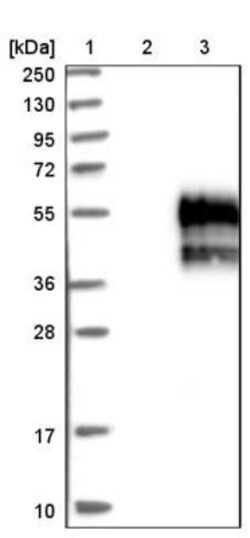TMIGD2 Antibody, Novus Biologicals:Antibodies:Primary Antibodies