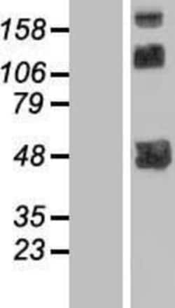 Novus Biologicals™ TMLHE Overexpression Lysate
