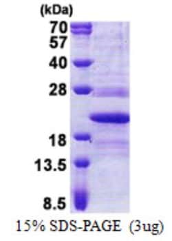 Novus Biologicals&trade;&nbsp;Recombinant Human Tmp21/p23 His Protein