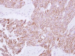 TMPRSS11B Antibody, Novus Biologicals 0.1mL; Unlabeled:Antibodies, Polyclonal