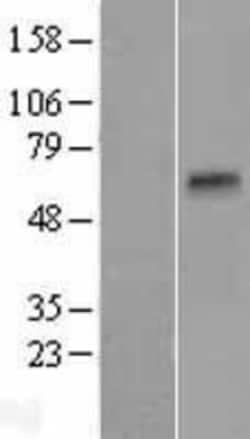 Novus Biologicals&trade;&nbsp;TMPRSS11B Overexpression Lysate