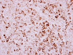 Airway Trypsin-like Protease/HAT/TMPRSS11D Antibody, Novus Biologicals 0.1 mL | Buy Online | Novus Biologicals | Fisher Scientific