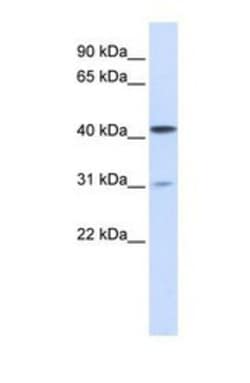 Airway Trypsin-like Protease/HAT/TMPRSS11D Antibody, Novus Biologicals