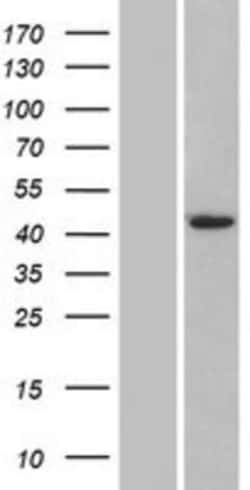 Novus Biologicals&trade;&nbsp;Airway Trypsin-like Protease/HAT/TMPRSS11D Overexpression Lysate