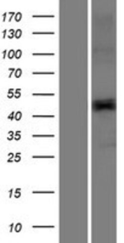 Novus Biologicals&trade;&nbsp;TMPRSS11E Overexpression Lysate