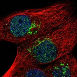 TMPRSS11F Antibody, Novus Biologicals 25 &mu;L, Unlabeled:Antibodies, Polyclonal