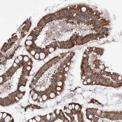 TMPRSS11F Antibody, Novus Biologicals 25 &mu;L, Unlabeled:Antibodies, Polyclonal