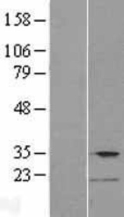 Novus Biologicals™ TMPRSS12 Overexpression Lysate