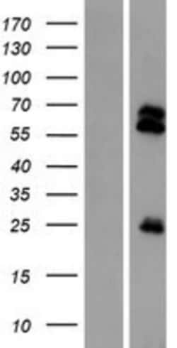 Novus Biologicals™ TMPRSS13 Overexpression Lysate