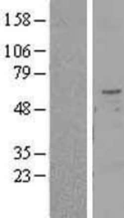 Novus Biologicals™ TMPRSS2 Overexpression Lysate