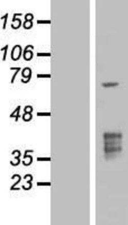 Novus Biologicals&trade;&nbsp;TMPRSS3 Overexpression Lysate