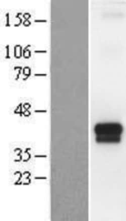 Novus Biologicals&trade;&nbsp;TMPRSS4 Overexpression Lysate