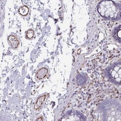 TMPRSS9 Antibody, Novus Biologicals:Antibodies:Primary Antibodies