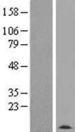 Novus Biologicals&trade;&nbsp;TMSB4Y Overexpression Lysate