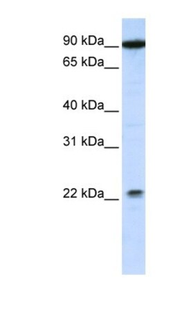 TMTC4 Antibody, Novus Biologicals 100 &mu;L | Buy Online | Novus Biologicals | Fisher Scientific
