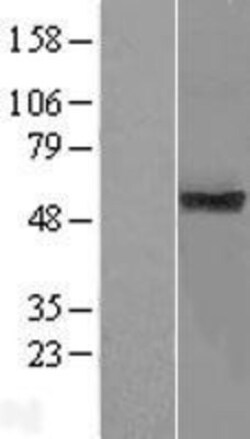 Novus Biologicals&trade;&nbsp;TMUB1 Overexpression Lysate
