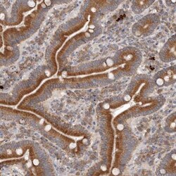 MDM1 Antibody, Novus Biologicals:Antibodies:Primary Antibodies