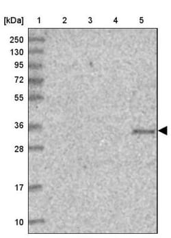 TMUB2 Antibody, Novus Biologicals 0.1mL; Unlabeled:Antibodies, Polyclonal