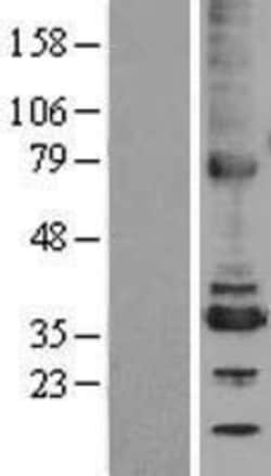 Novus Biologicals&trade;&nbsp;TMX2 Overexpression Lysate