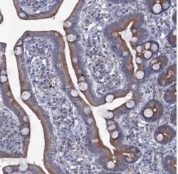 TMX2 Antibody, Novus Biologicals:Antibodies:Primary Antibodies